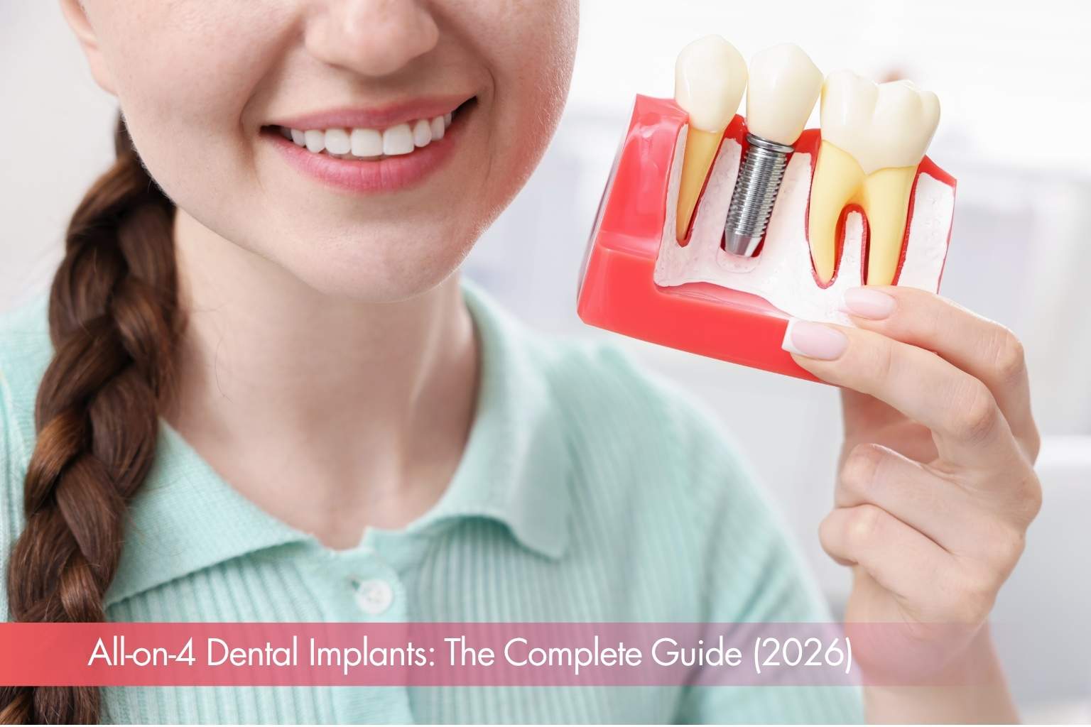 All-on-4 Dental Implants: The Complete Guide (2026)