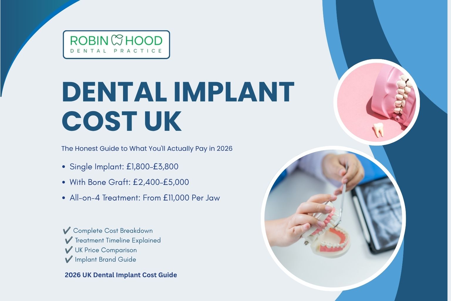 Dental Implant Cost UK: The Honest Guide to What You'll Actually Pay in 2026