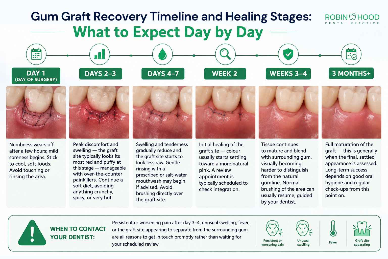 Gum Graft Recovery Timeline and Healing Stages:What to Expect Day by Day