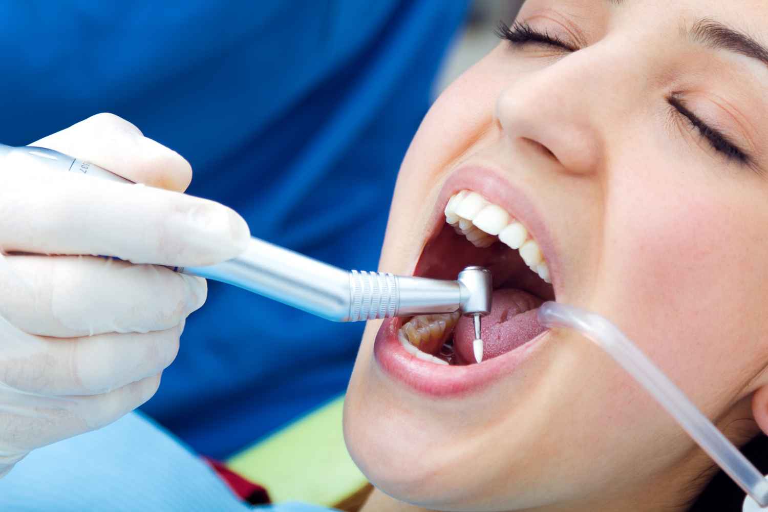 Root Canal Treatment Birmingham — The Honest Guide