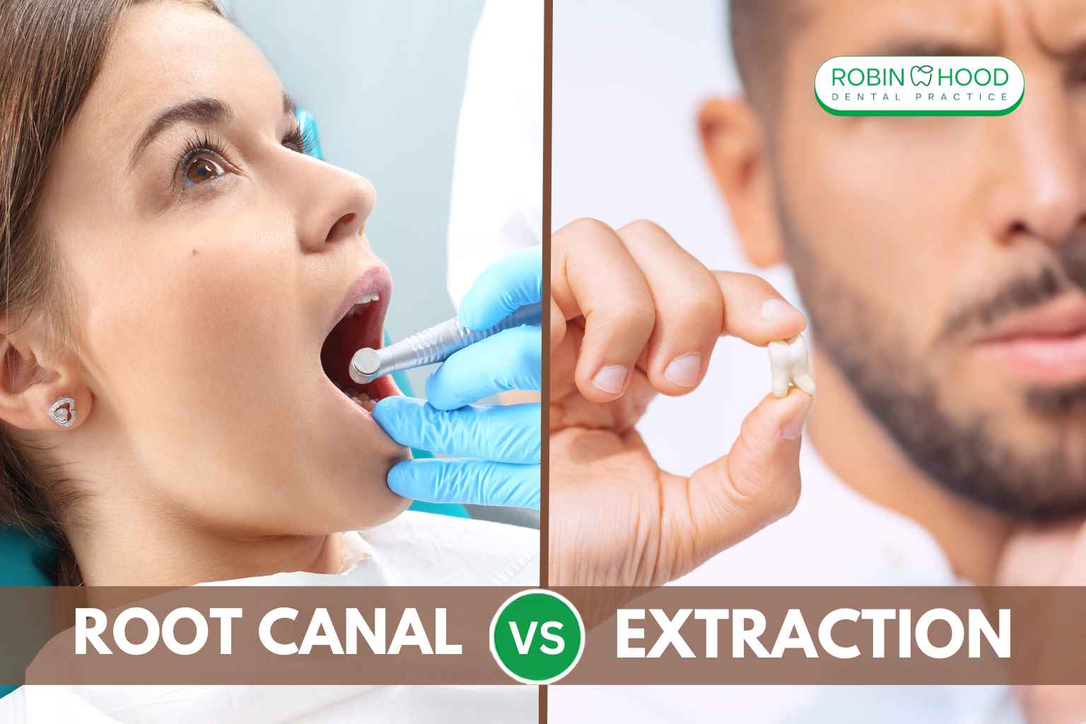 Root Canal vs Emergency Extraction: Which Is Right for You?