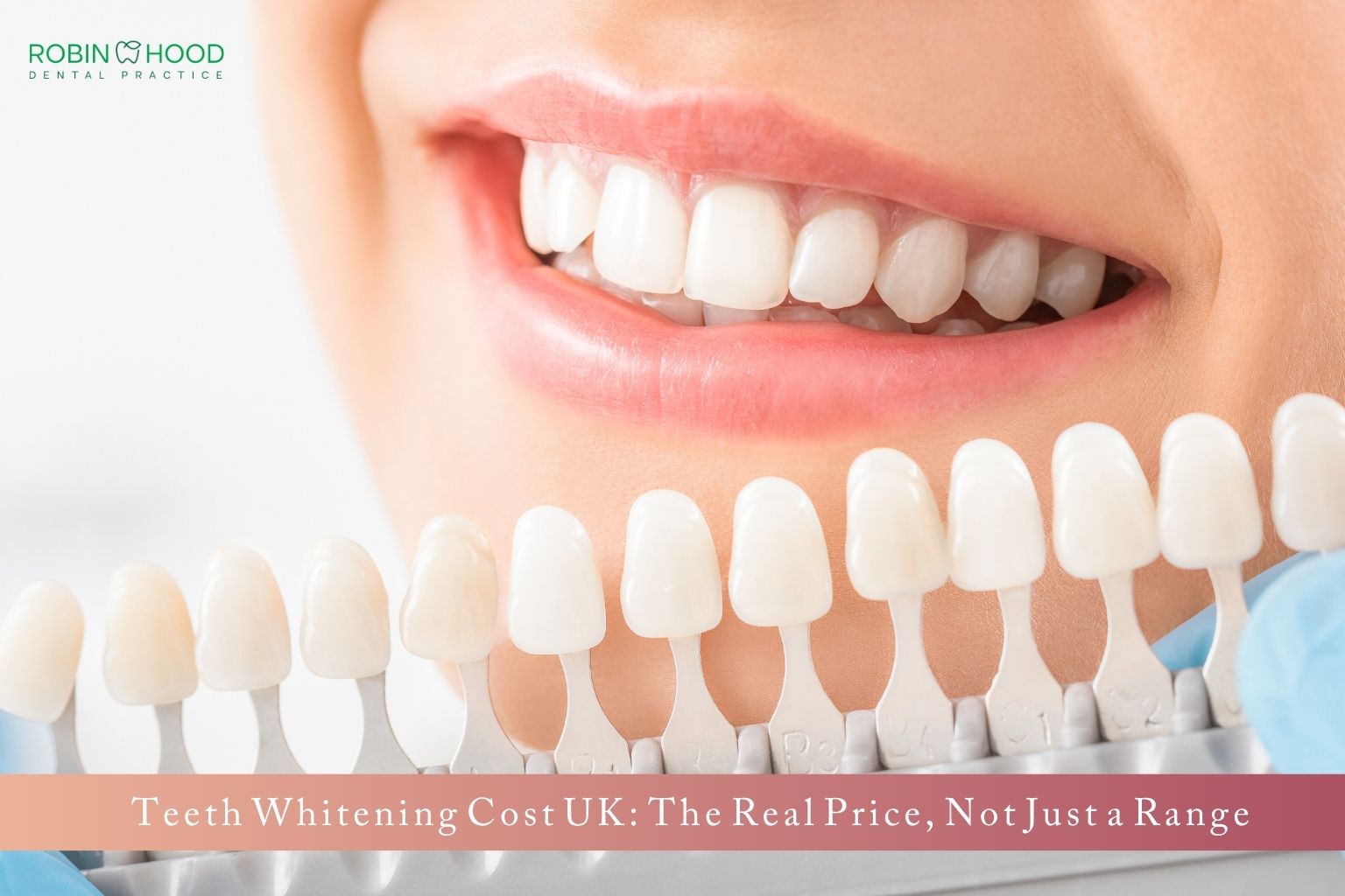 Teeth Whitening Cost UK: The Real Price, Not Just a Range