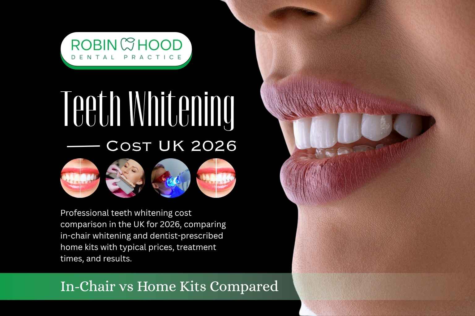 Teeth Whitening Cost UK 2026: £175–£700 Compared