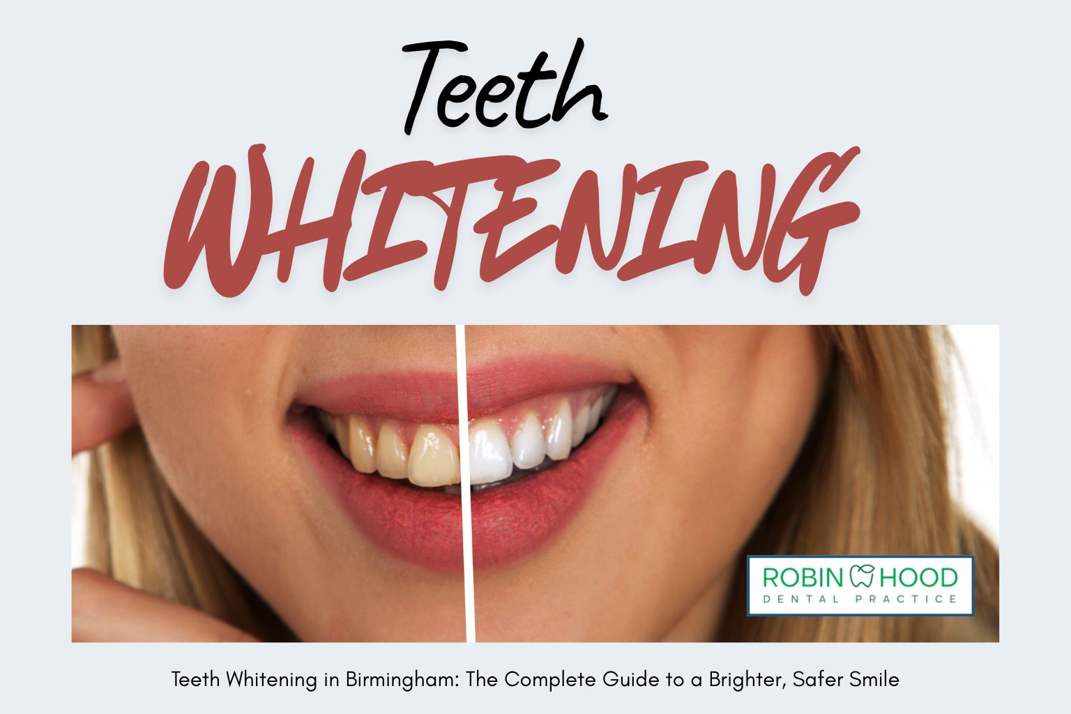 Teeth Whitening in Birmingham: The Complete Guide to a Brighter, Safer Smile