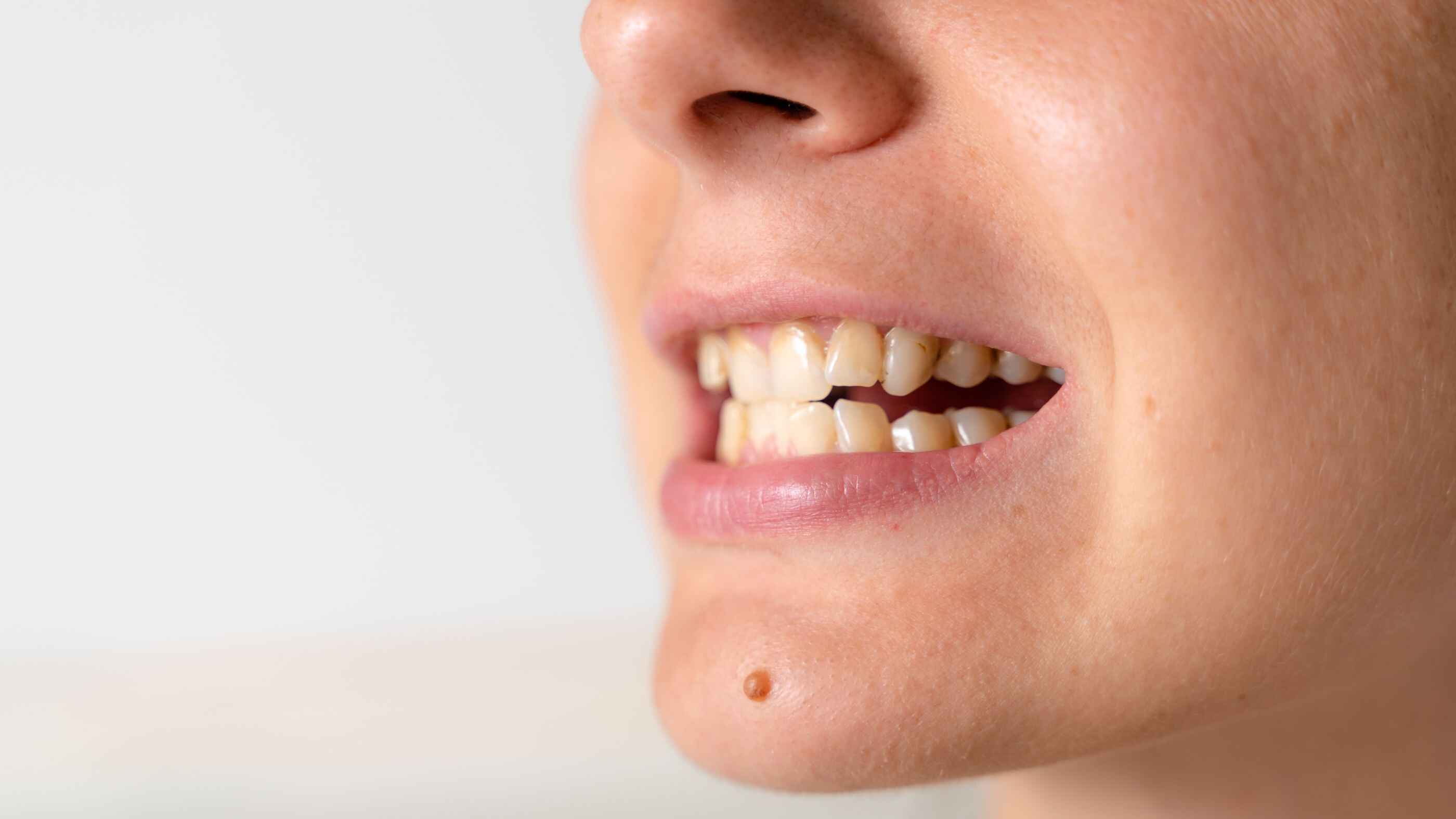 Why Are My Teeth Yellow Even Though I Brush? A Dentist Explains