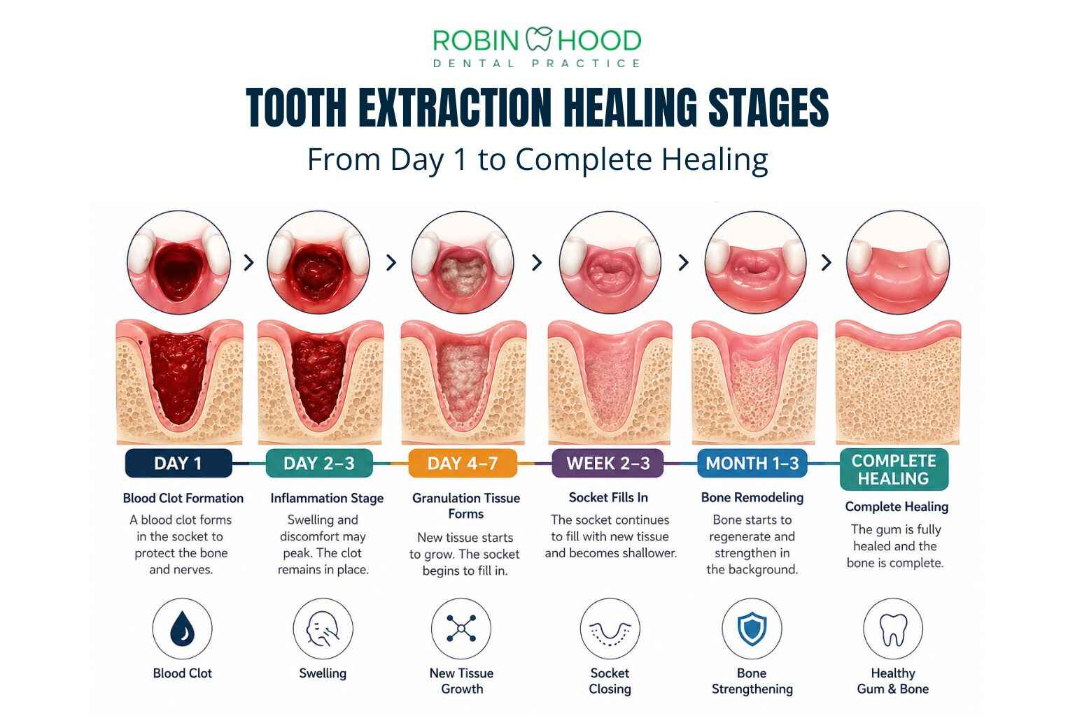 Tooth Extraction Healing: What to Expect Day by Day