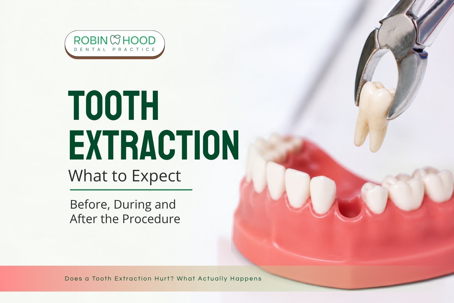 Tooth Extraction: What to Expect Before, During, and After the Procedure