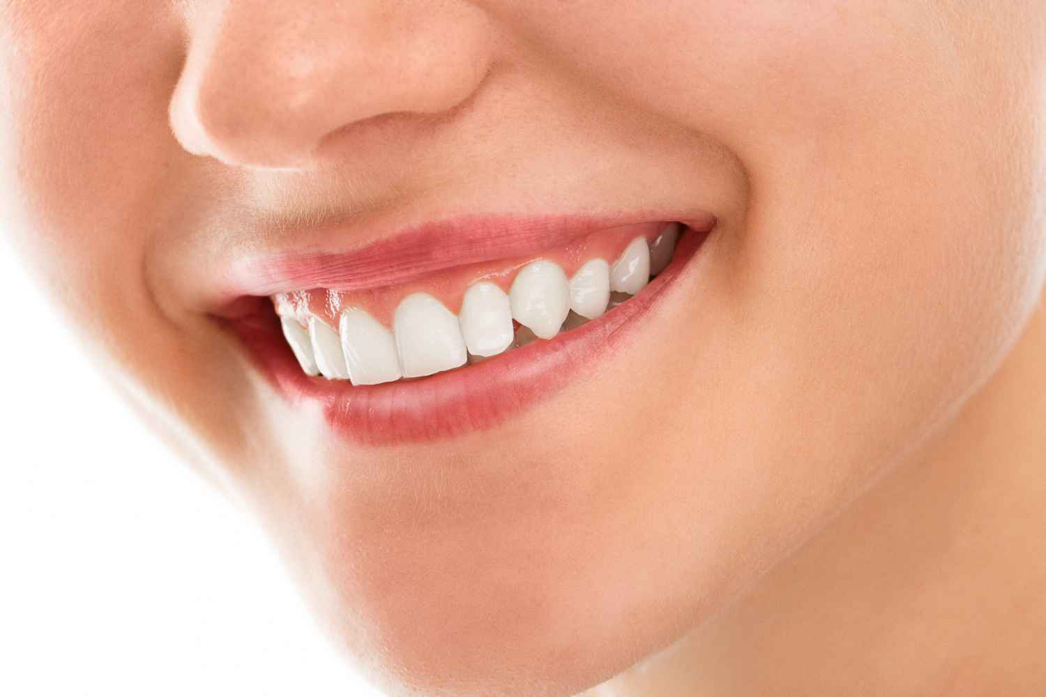 Teeth Whitening & Dental Implants in Birmingham, UK